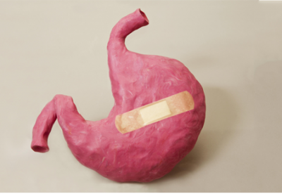 胃溃疡是怎么形成的？出现这几种情况，警惕胃溃疡发生变化